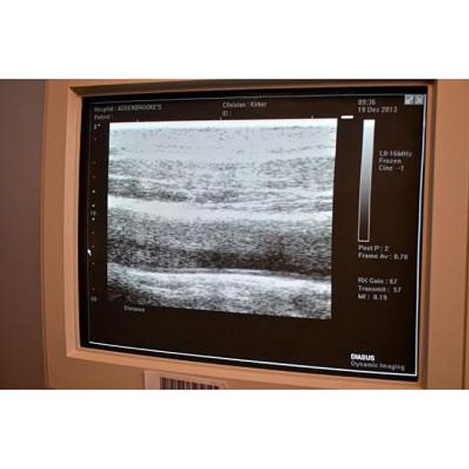 Used DYNAMIC IMAGING DIASUS ULTRASOUND SCANNER WITH 2 PROBES