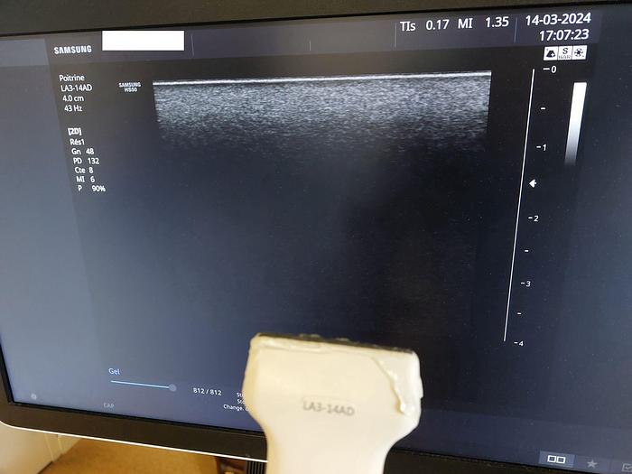 D'occasion SAMSUNG HS50 ULTRASOUND