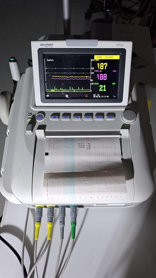 Rénové TOCOCARDIOGRAPHE CTG  PHILIPS GOLDWAY (gemellaire) FHR FETAL MONITOR TWINS