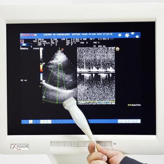 ESAOTE PA 240 CARDIAC LEAD