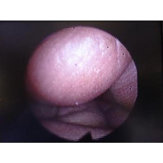 Used OLYMPUS HYF-XP FLEXIBLE HYSTEROFIBROSCOPE, VERY GOOD CONDITION