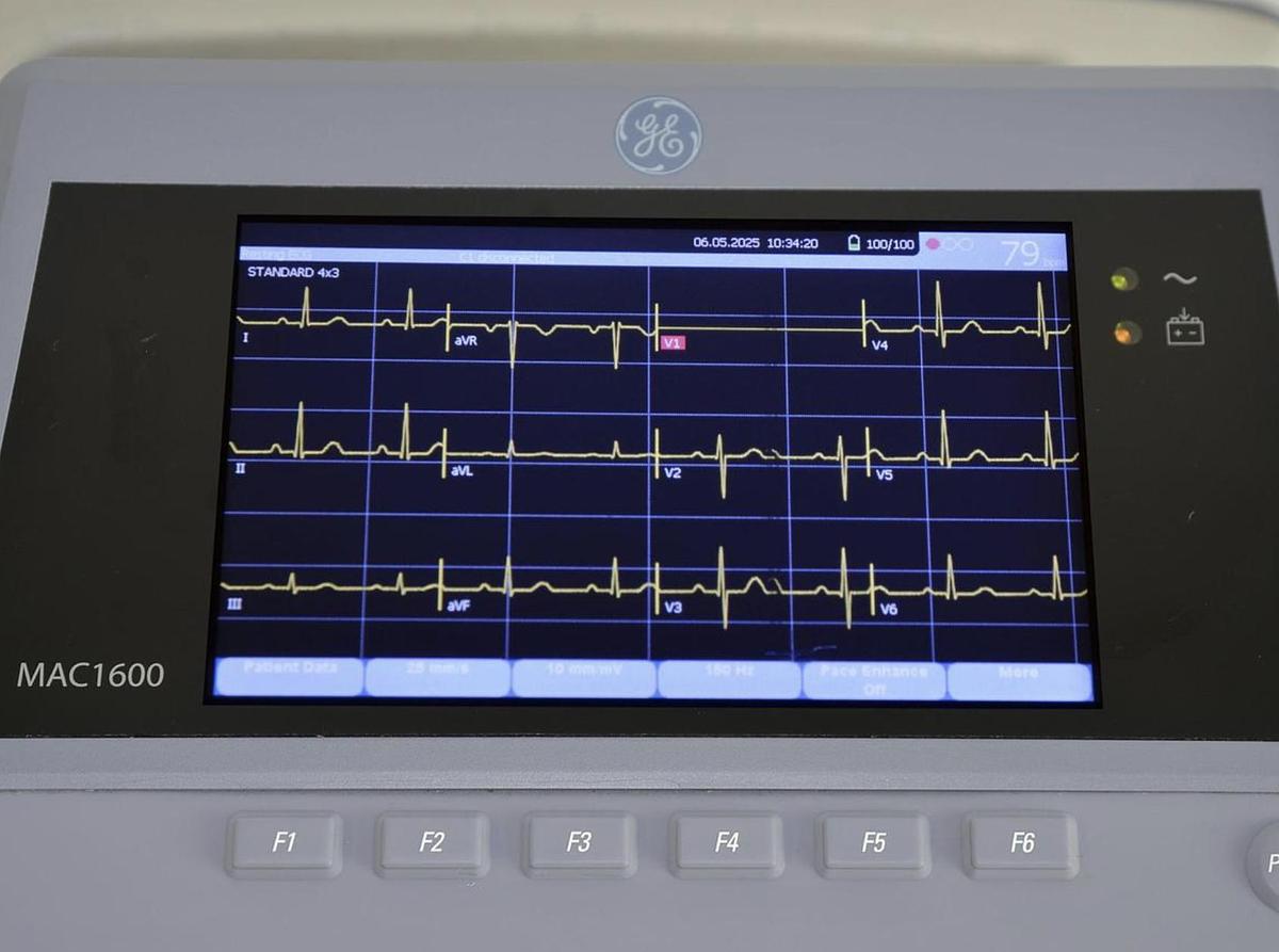D'occasion ECG ELECTROCARDIOGRAMME GENERAL ELECTRIC MAC 1600