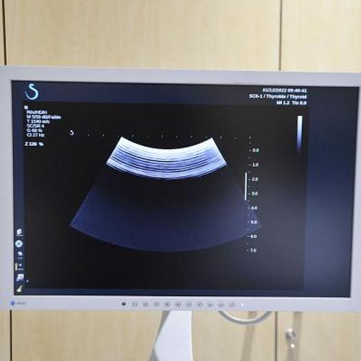 Used SUPERSONIC IMAGINE AIXPLORER ULTRASOUND SCANNER