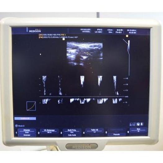 Used ECHO-DOPPLER SAMSUNG MEDISON SONOACE X8