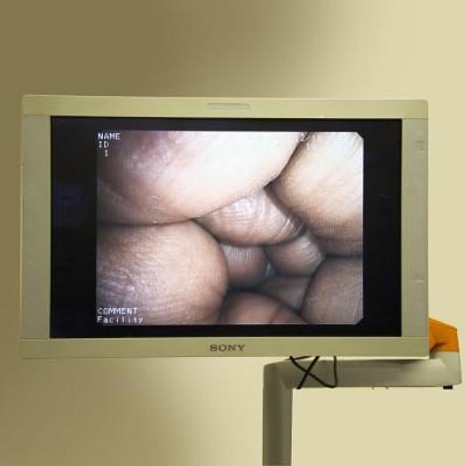 Used PENTAX GASTROENTEROLOGY COLUMN WITH 28" FLAT SCREEN