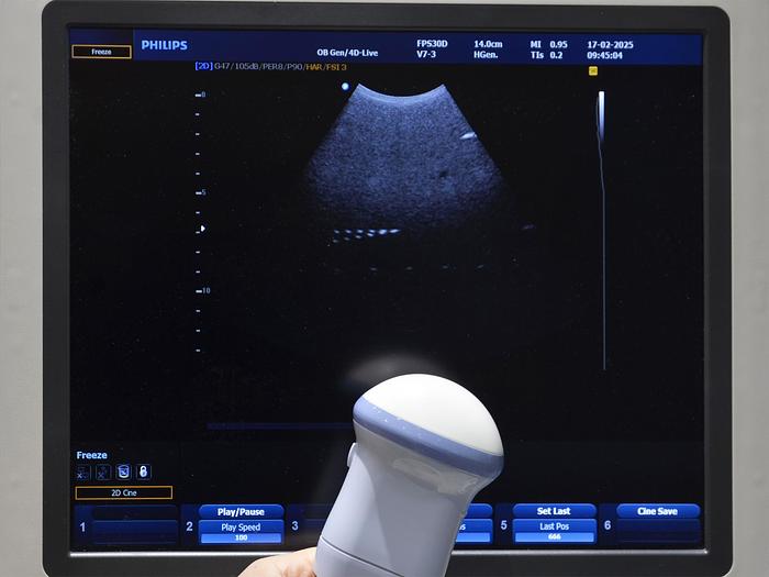 Used PHILIPS HD9 3D/4D ULTRASOUND with 4 PROBES