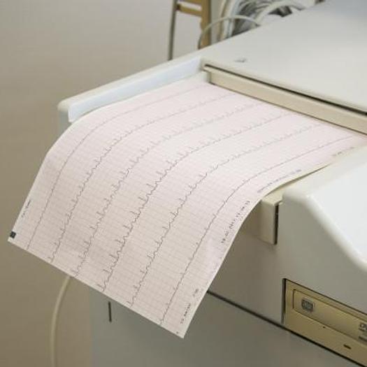 Used STRESS AND REST ECG SCHILLER CARDIOVIT CS 200