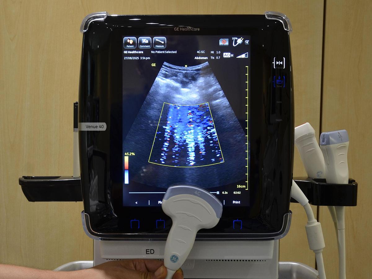D'occasion GENERAL ELECTRIC GE VENUE 40 PORTABLE ULTRASOUND ON ITS MOBILE STAND