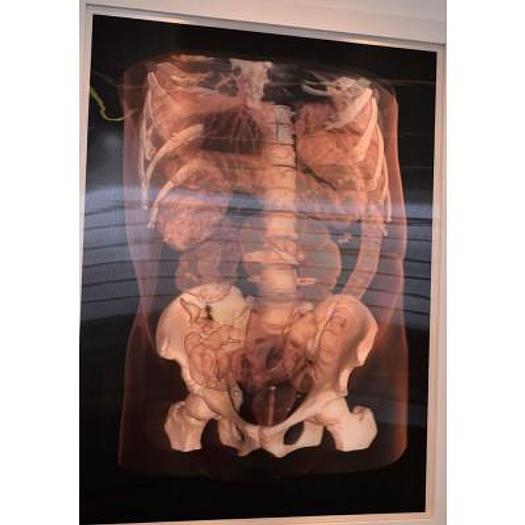 Used HOLOGRAPHIC CHART OF THE DIGESTIVE SYSTEM