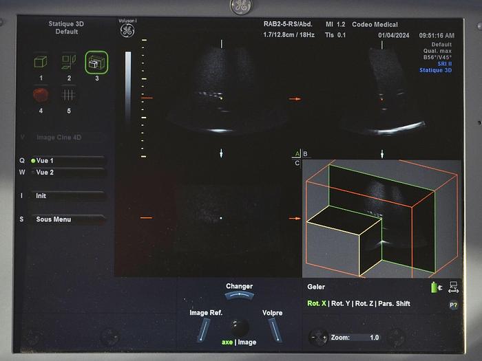 Used GENERAL ELECTRIC VOLUSON-I PORTABLE ULTRASOUND SCANNER ON CART