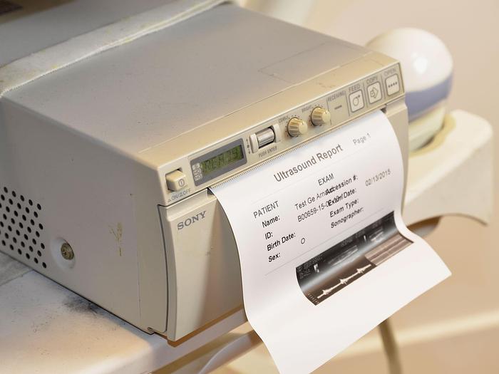 Used GENERAL ELECTRIC VOLUSON-I PORTABLE ULTRASOUND SCANNER ON CART