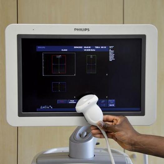 Used PHILIPS IU22 3D/4D RADIO ECHOCARDIOGRAPH + CARDIO + GYNECO