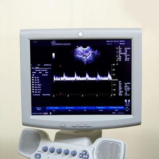 Used LOGIQ A5 GENERAL ELECTRIC ULTRASOUND SCANNER WITH FLAT SCREEN