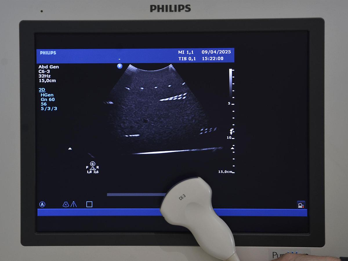 original-d-occasion-echographe-philips-hd-15-2-d-3-d-4-d-gyneco-et-radio.JPG