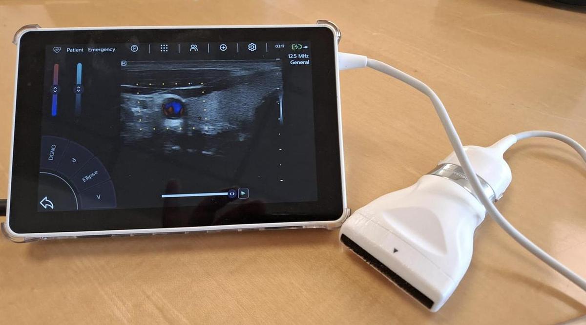D'occasion ULTRA LITE SONOSCANNER AVEC SONDE LINEAIRE