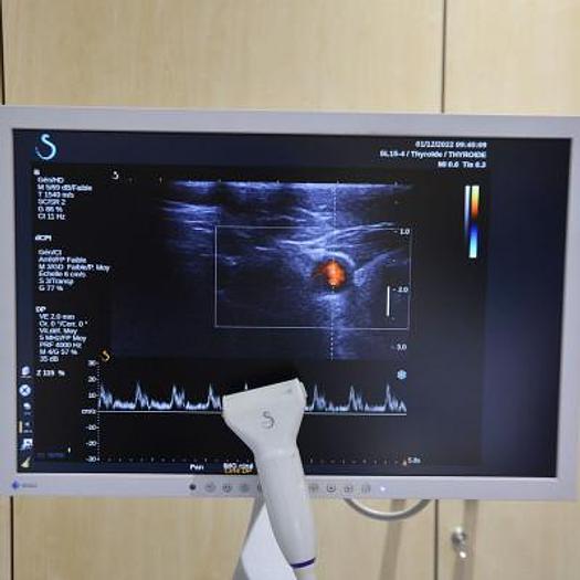 Used SUPERSONIC IMAGINE AIXPLORER ULTRASOUND SCANNER