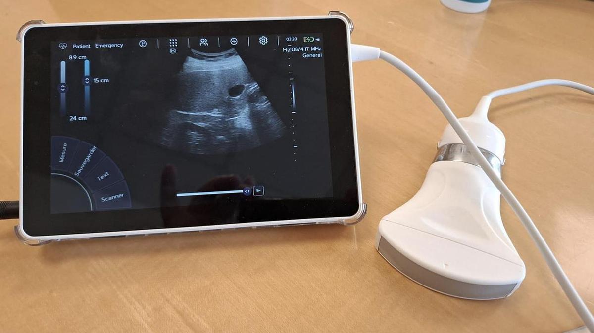 D'occasion ECHOGRAPHE SUPER PORTABLE SONOSCANNER U-LITE PRO AVEC 3 sondes interchangeables : convexe, lineaire, cardiaque