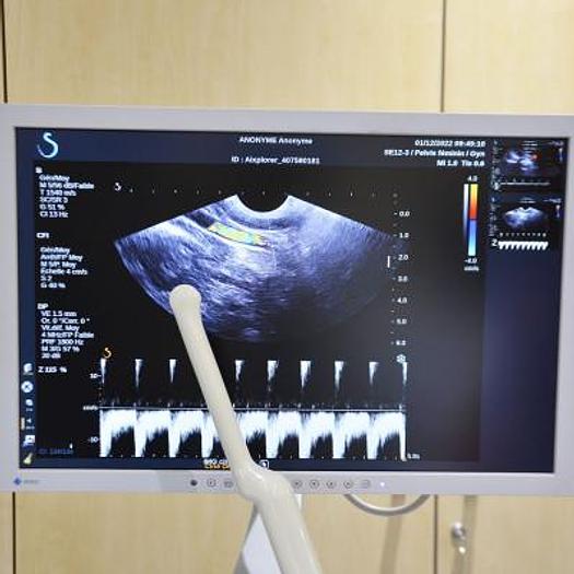 Used SUPERSONIC IMAGINE AIXPLORER ULTRASOUND SCANNER