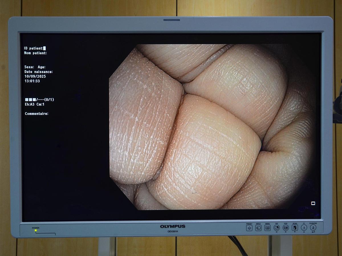 D'occasion OLYMPUS EXERA III CV190 VIDEO COLUMN WITH 2 ENDOSCOPES