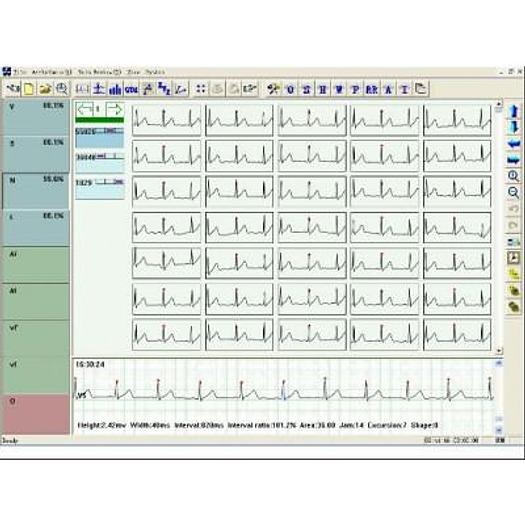 ECG HOLTER