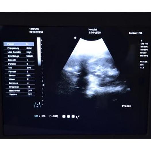 CAMSONIC 500 PORTABLE DIGITAL DOPPLER COLOR ULTRASOUND WITH 2 PROBES
