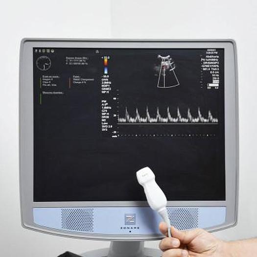 Used MINDRAY ZONARE ECHOCARDIOGRAPH