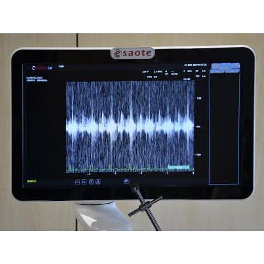 Used ECHOCARDIOGRAPHER ESAOTE MyLabSeven