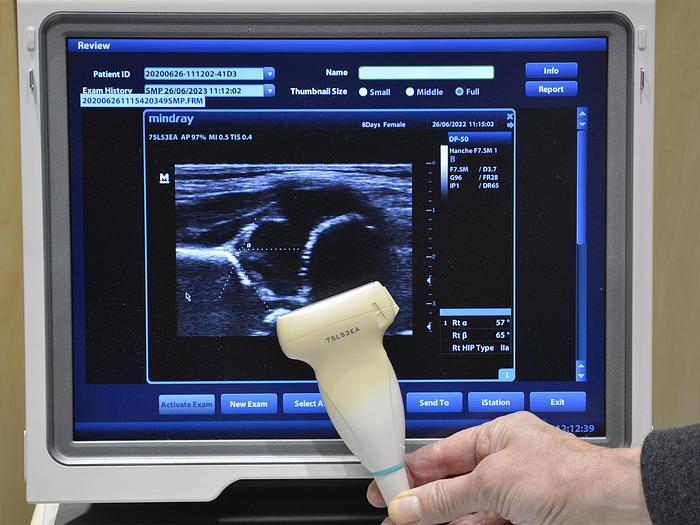 D'occasion ECHOGRAPHE MINDRAY DP-50