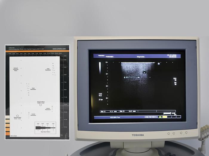 D'occasion ECHOGRAPHE TOSHIBA XARIO