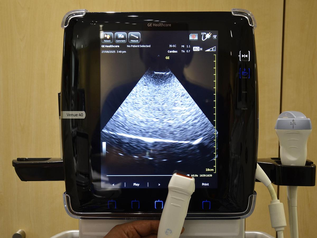 D'occasion GENERAL ELECTRIC GE VENUE 40 PORTABLE ULTRASOUND ON ITS MOBILE STAND