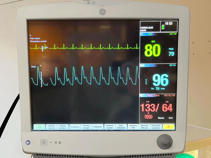 Used GENERAL ELECTRIC ADVANCE CS2 ANESTHESIA RESPIRATOR with MONITORING ANESTHESIA CARESCAPE