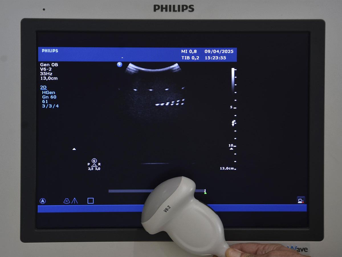 original-d-occasion-echographe-philips-hd-15-2-d-3-d-4-d-gyneco-et-radio.JPG