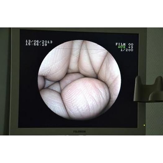 Used FUJINON DIGESTIVE ENDOSCOPY COLUMN WITH FUJINON FLAT PANEL MONITOR 19 CDL1904A