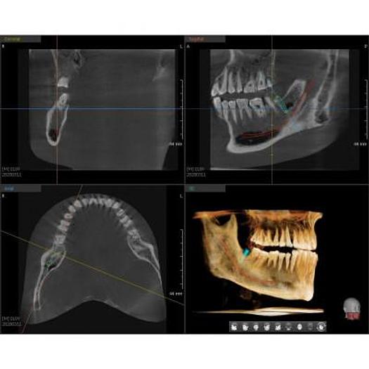 Used VATECH PAX I 3D SMART DENTAL PANORAMIC with CEPHALOSTAT (Panorama + Cephalo Scan Shot + CBCT)