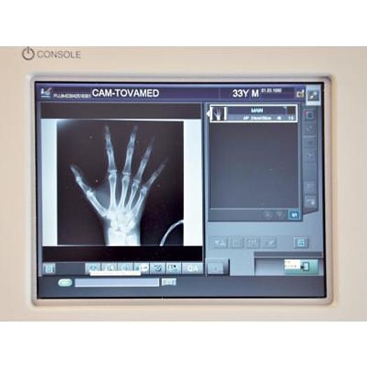 Used FUJINON GO DIGITAL MOBILE RADIO