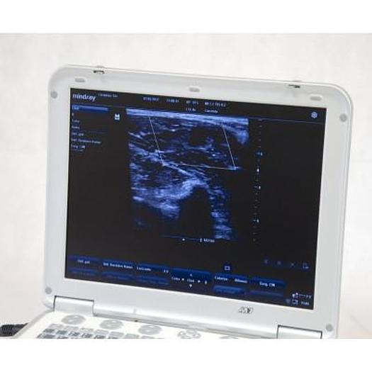 Used MINDRAY M7 PORTABLE ULTRASOUND SCANNER ( 2013 )
