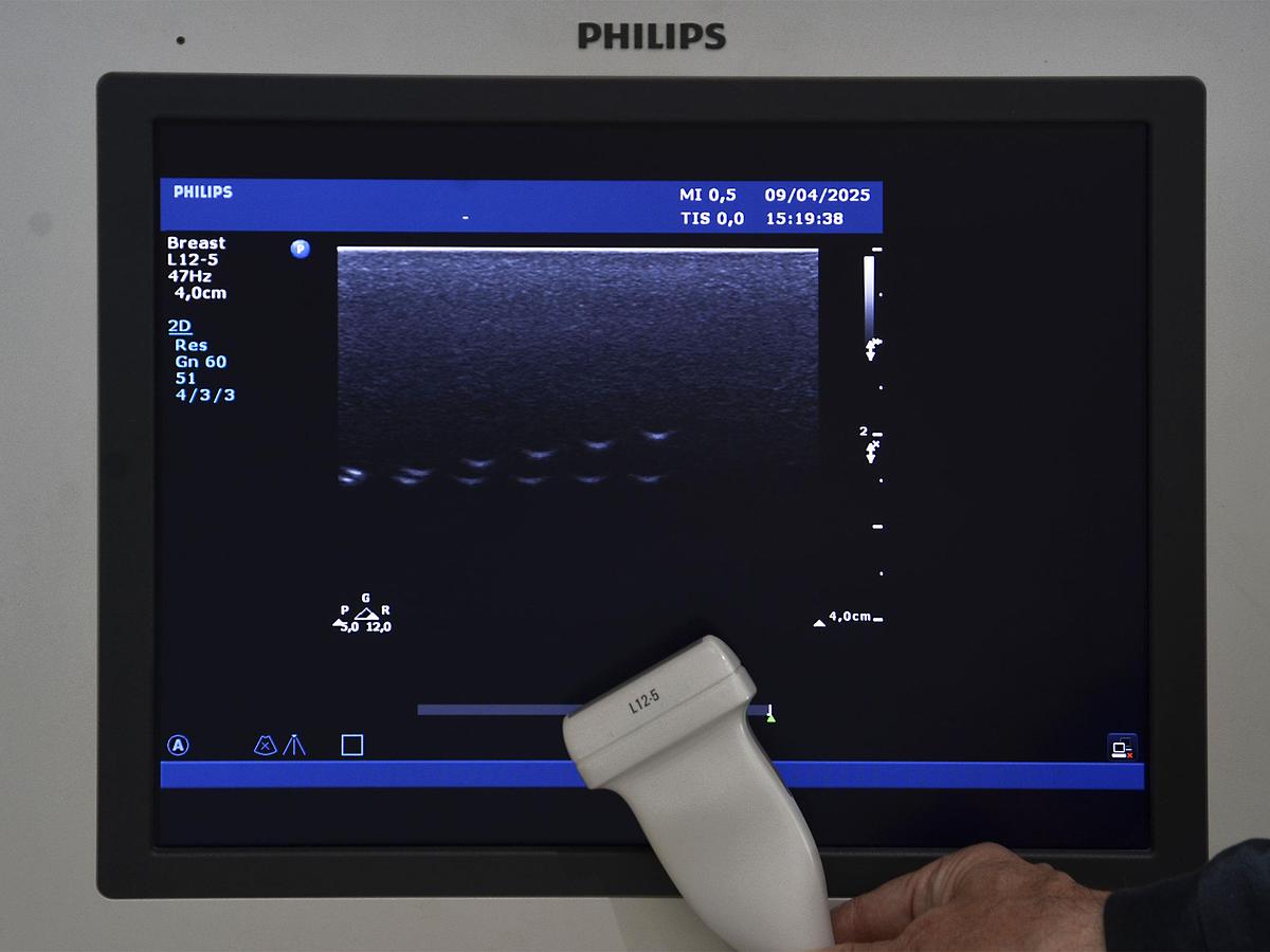 original-d-occasion-echographe-philips-hd-15-2-d-3-d-4-d-gyneco-et-radio.JPG