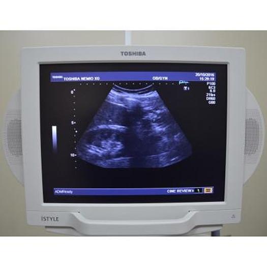 Used ULTRASOUND SCANNER TOSHIBA NEMIO XG ISTYLE SSD 580A COLOR, DOPPLER, FLAT SCREEN