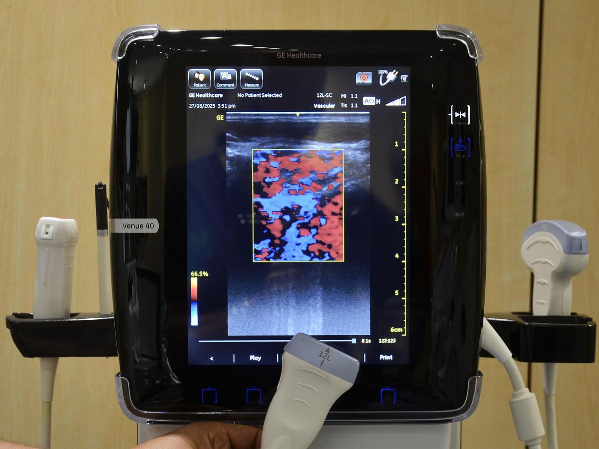 D'occasion GENERAL ELECTRIC GE VENUE 40 PORTABLE ULTRASOUND ON ITS MOBILE STAND