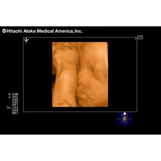 Used ALOKA/HITACHI PROSOUND 3500SX COLOR 3D/4D DOPPLER ULTRASOUND SCANNER