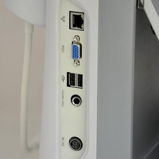 CHISON ECO1 PORTABLE ULTRASOUND WITH ABDOMINAL PROBE