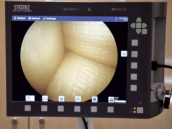 Used KARL STORZ TELEPAK X  COMPACTOSCOPE - Model 20212030