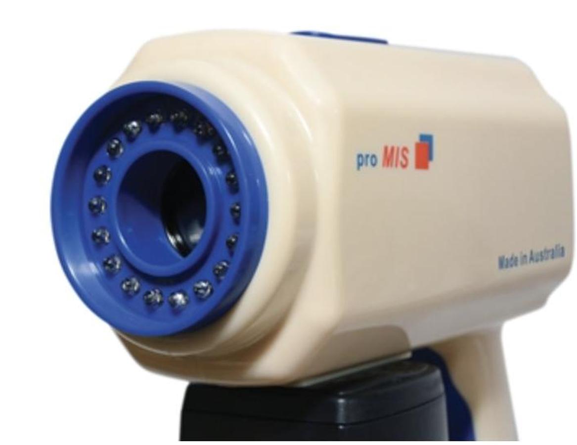 DIGITAL VIDEO COLPOSCOPE