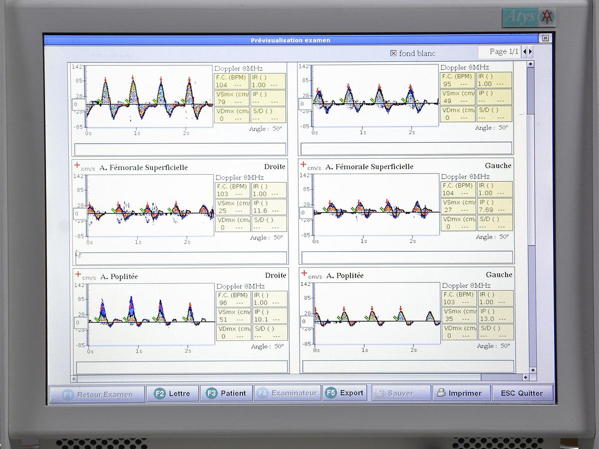 D'occasion ATYS WAKIE TRANSCRANIAL DOPPLER WITH 2 PROBES (X MHZ and Y MHZ)