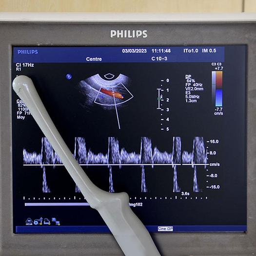 Used ECHOCARDIOGRAPHE PHILIPS IE33 RADIO CARDIO GYNECO