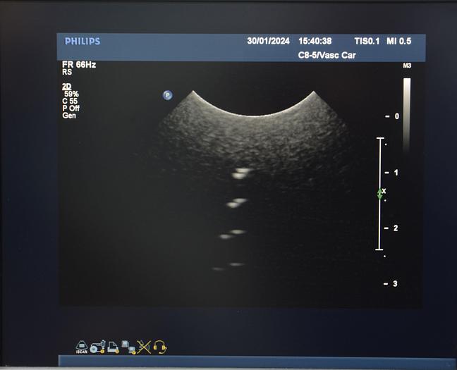 D'occasion ECHOGRAPHE PHILIPS IU22