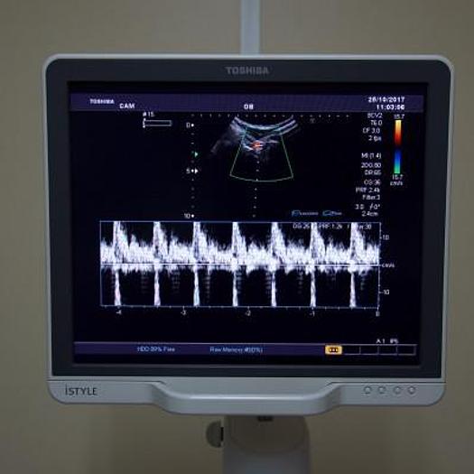 Used TOSHIBA APLIO MX COLOR DOPPLER ULTRASOUND SCANNER