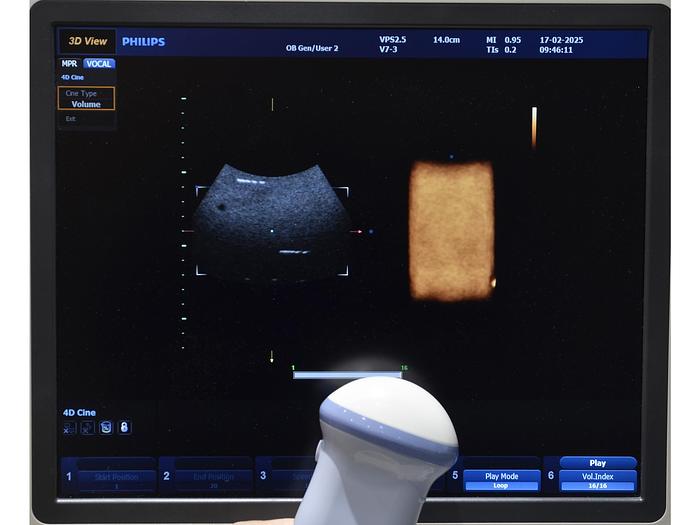Used PHILIPS HD9 3D/4D ULTRASOUND with 4 PROBES