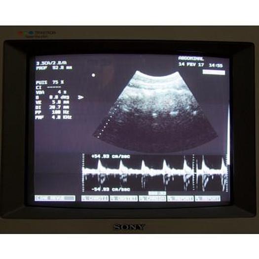 Used ESAOTE MEDICA AU4 IDEA COLOR DOPPLER ULTRASOUND SCANNER WITH 2 PROBES