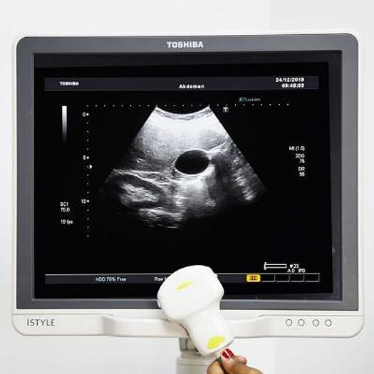 Used TOSHIBA APLIO MX ULTRASOUND SCANNER